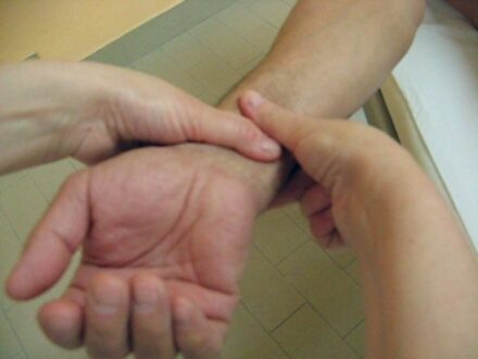 depressione trattamento tui na