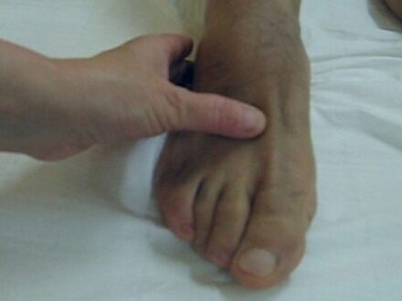 parkinson 3f metodo tassi